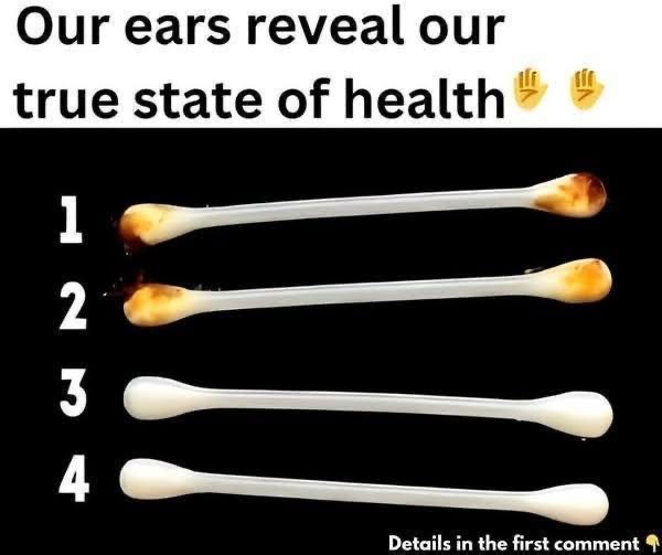 What the Color of Your Earwax Says About Your Health — Doctors Explain What to Watch For