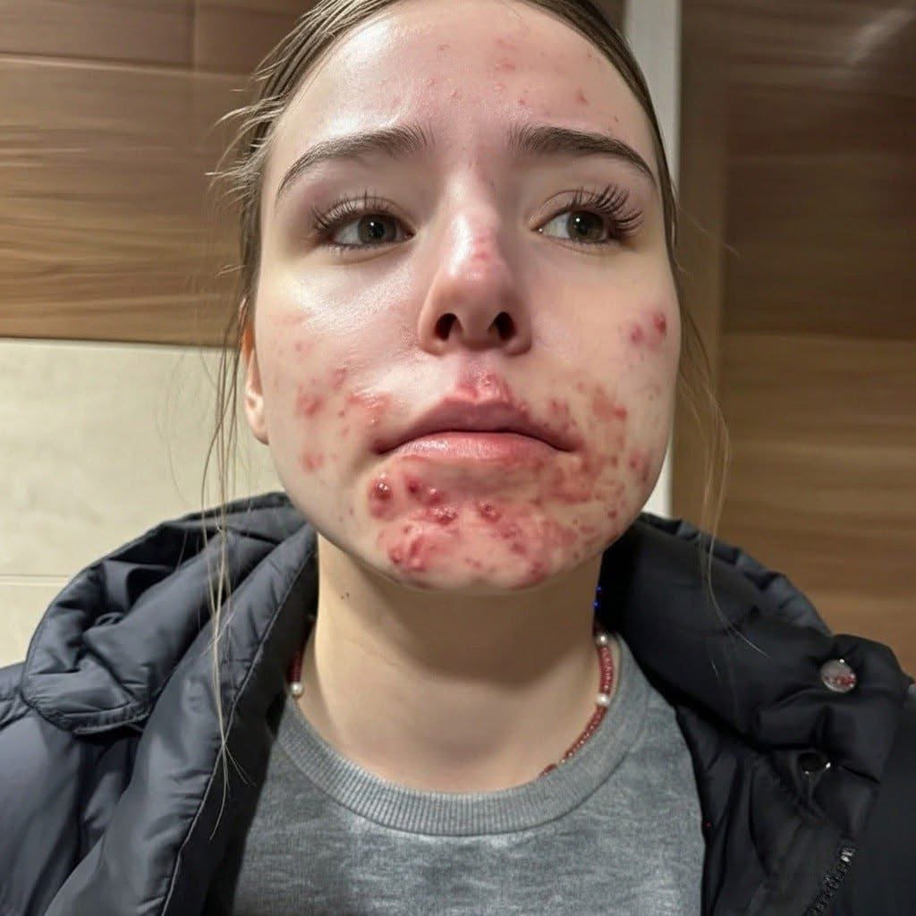 Be careful! These are the consequences o