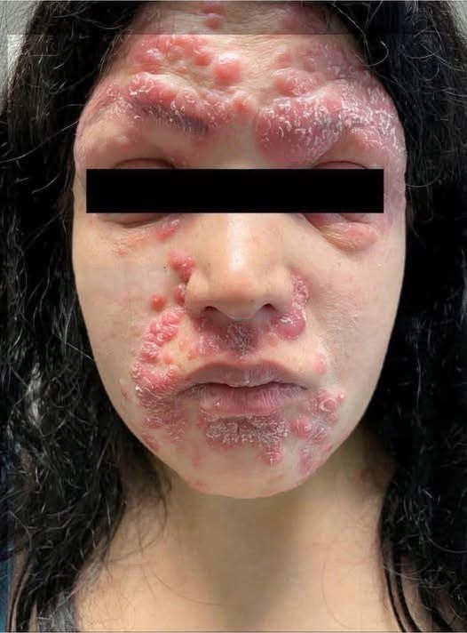 These are the consequences of sleeping with…See more