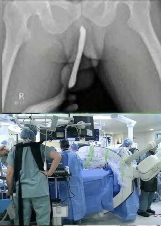 Teen Rushed to Hospital After Dangerous Experiment: A Stark Reminder on Safety