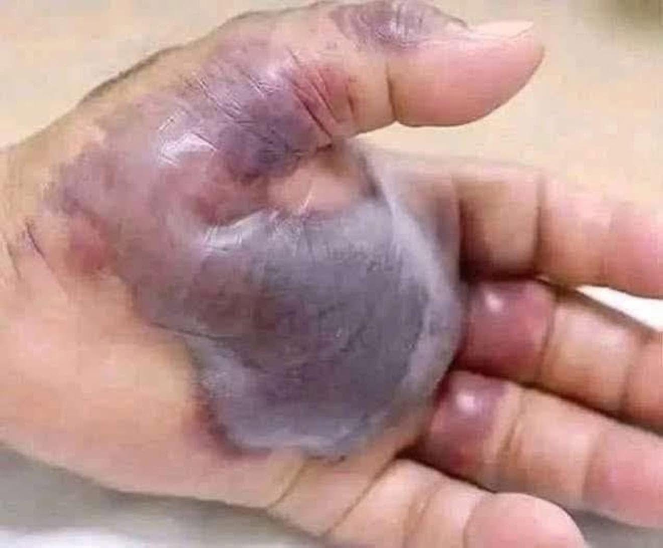 ATTENTION to these first signs of