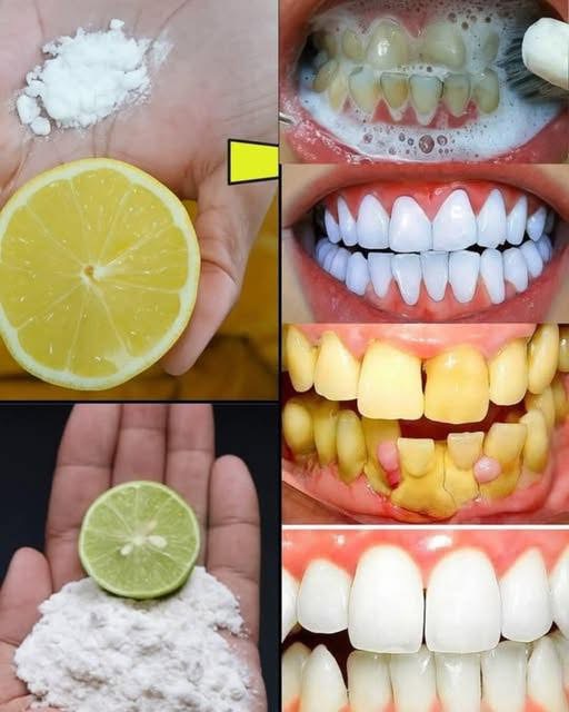 Discover the Hidden Sparkle: Transform Your Smile with the Baking Soda and Lemon Magic Duo!