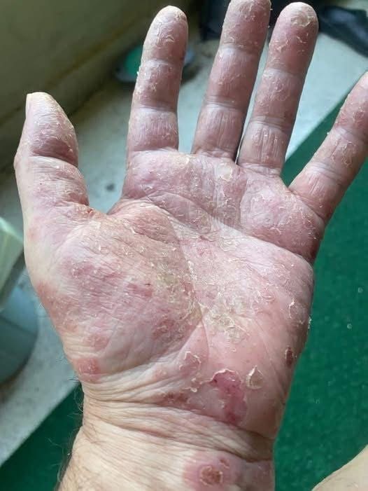 Signs He’s Growing Cold — And What It Really Means