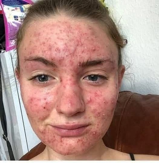 Her Skin Was Itching for Weeks — Doctors Thought It Was “Just an Allergy”… Until One Specialist Finally Revealed the Truth