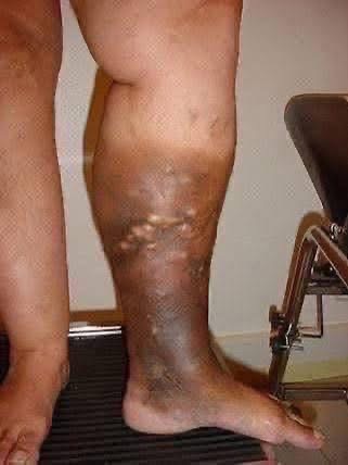 These are the first symptoms of a… See more