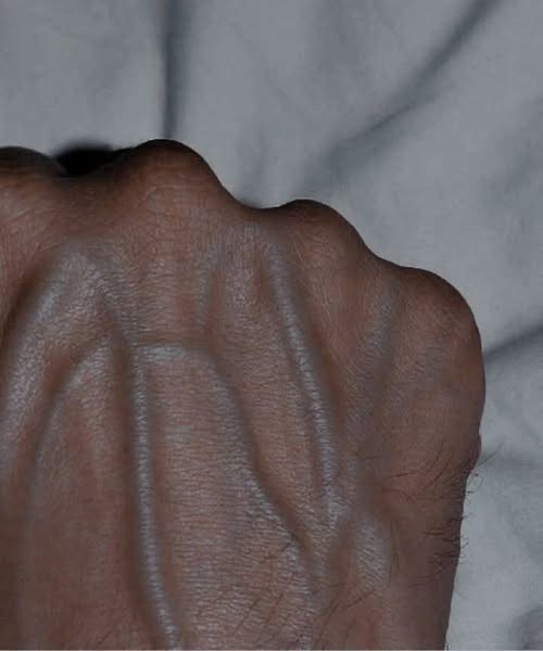 Why Your Veins Appear More Prominent Overnight