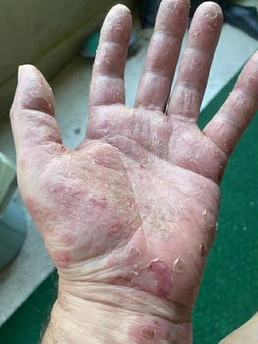 Signs He’s Growing Cold — And What It Really Means