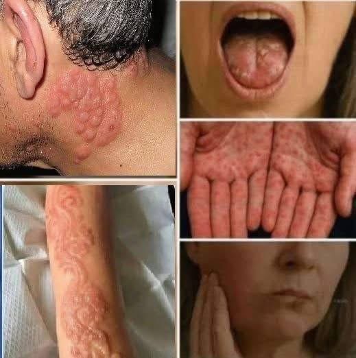 Warning Signs Many People Ignore