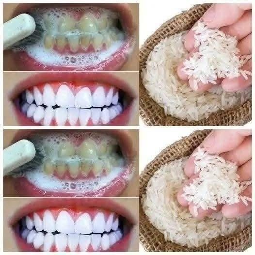 Teeth Whitening Trick with Rice — A Natural, 1-Minute Smile Brightener (Or Cautionary Tale?)