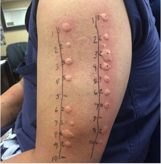 The Hidden Signs People Ignore