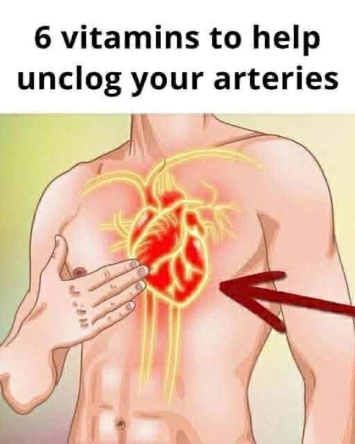 6 vitamins that can help with clogged arteries
