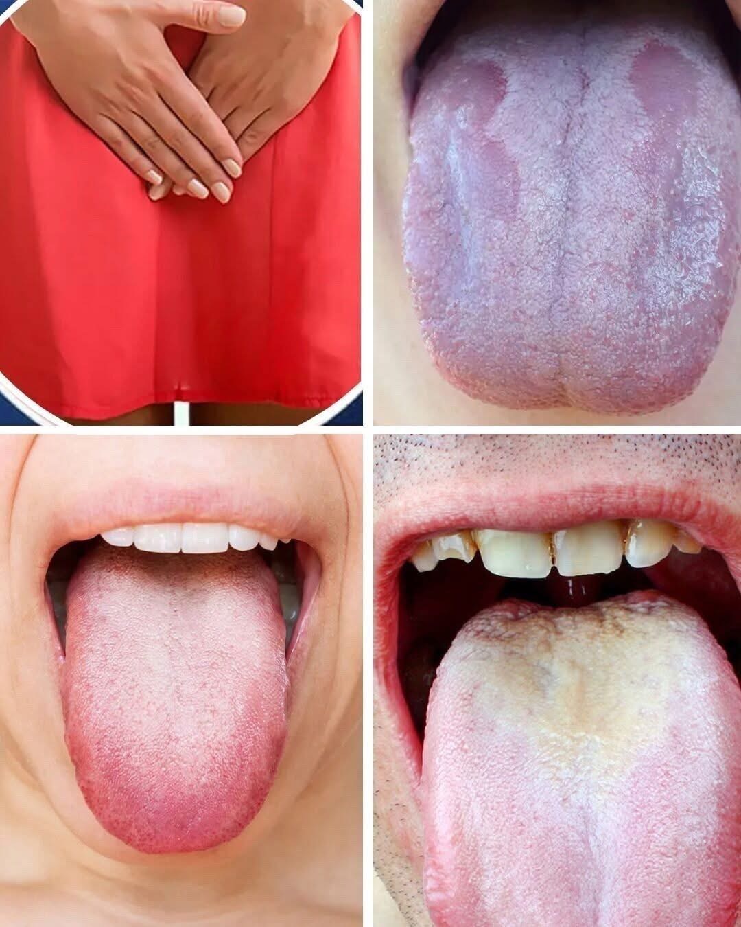 What Your Tongue Has Been Warning You