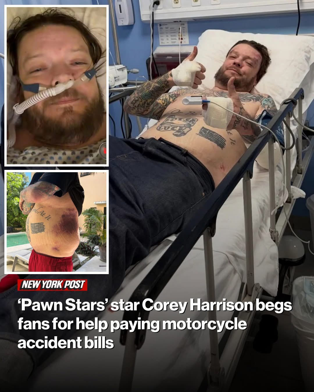 Pawn Stars’ star Corey Harrison begs fans for help paying motorcycle accident bills