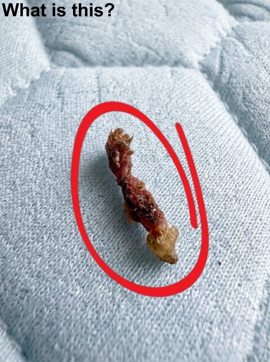 I Woke Up Thinking Something Was Biting Me—The Truth Shocked Me